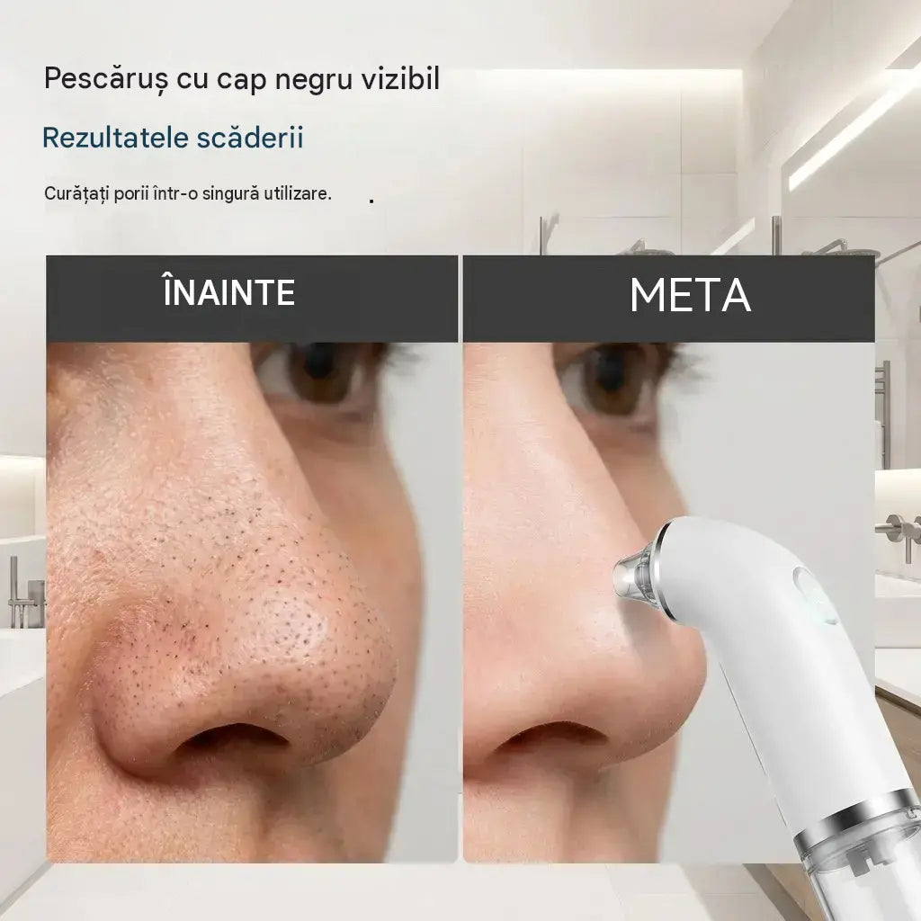 Demachiant electric pentru față · Strânge și lifting · Curățare profundă a porilor