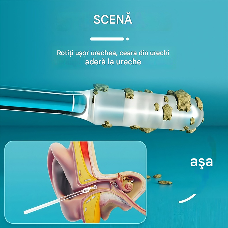 🔥50% reducere! 🔥👂 [Îndepărtare super puternică a cerumenului] Bețișor de curățare a cerumenului, nou-nouț, special conceput